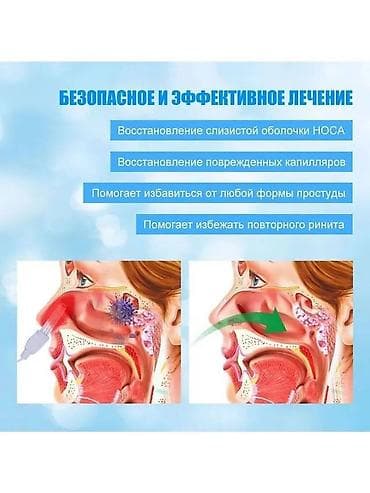 Nitril əlcəklər: Burun üçün lazer müalicəsi cihazı Rinit,sinusit xəstəlikləri zamanı — 4