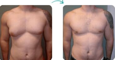 qarin eritmek ucun krem: Estetik–plastik cərrahiyyə və bədən formalaşdırma xidmətləri Təklif — 16