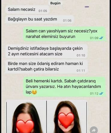 таблетки для похудения в баку: Saç üçün yağ, Saç tökülməsinə qarşı — 5