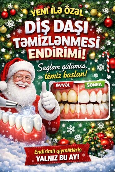 diş: Yeni ilə özəl diş daşı təmizlənməsi xidməti - Peşəkar skeylinq — 1