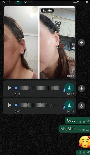 don sekilleri: Bu kremler netice superdi butun sekiller heqiqidi ve kasmetoloq — 8