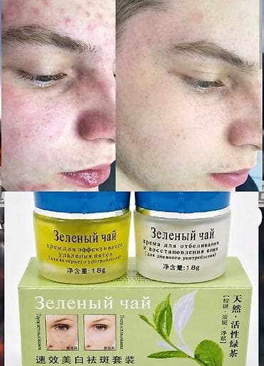 savis a e крем отзывы: Yawil cay kremi uzdeki lekeleri aparir, derini cavanlasdirir — 1