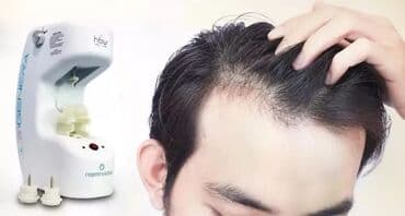 ozonator aparati: Regenera Activa (kök hüceyrə aparatı) . İstehsal ölkəsi : İtaliya 1 — 3