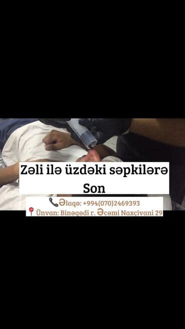 ağ dırnaq modelleri: Hicamanın Faydaları✅ *Qan dövranın pozulması *Qanın təmizlənməsi — 2