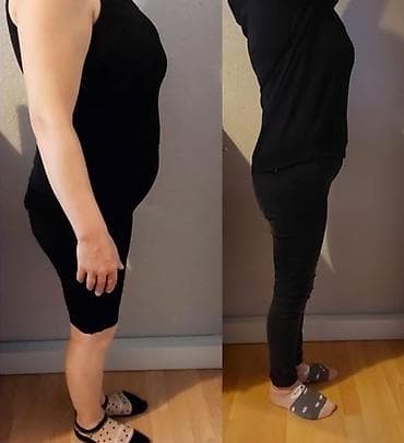 bakıda masaj: Arıqlama masajı, Qadınlar üçün, Evə gəlməklə, Klinikada — 1