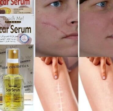 Serum
Capiq yara eleyhine