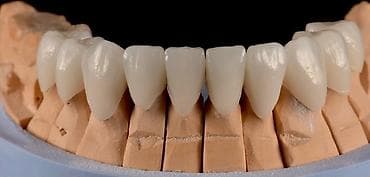 Paltar tikişi: Salam hörmətli və dəyərli Diş Həkimlərimiz.mən diş Texnikiyem.Bakının — 2