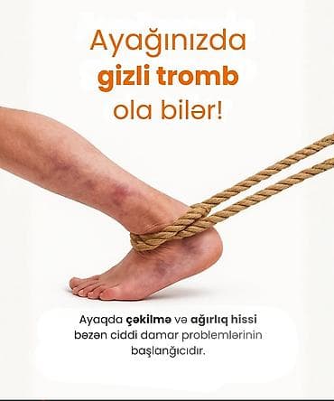 varikoz corabı: Varikoz müalicəsi, Klinikada — 1