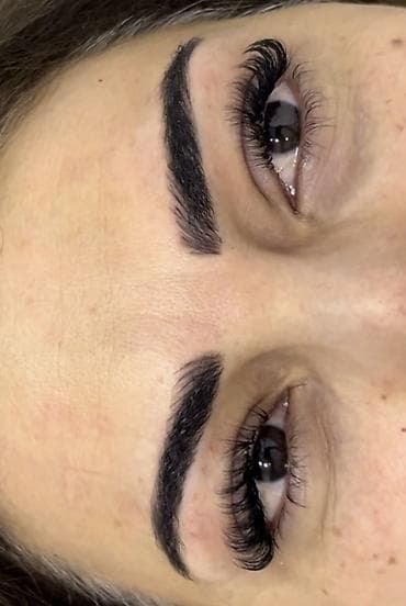 prostat masajı bakida: Kırpık qaynagi❤️‍🔥 — 2