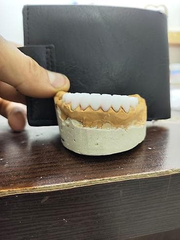 Услуги: Diş texnikliyi kursları(6 ay erzinde tam öyredilir, stomotoloji — 5