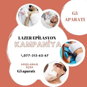 lazer epilyator qiymeti: Лазерный эпилятор — 1