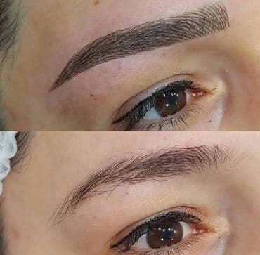 qısa saç modelləri: Seyrek formasiz qaslarin mikrobledinqle berpasi — 5