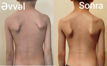 zirkon keramika diş qiymetleri: Müalicəvi masaj, Uşaqlar üçün, Kişilər üçün, Qadınlar üçün, Klinikada — 4