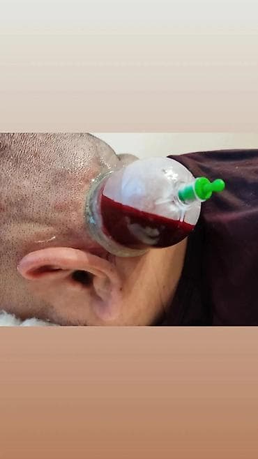 gencede xeste baxicisi: Müalicəvi masaj, Kişilər üçün, Qadınlar üçün, Evə gəlməklə — 7