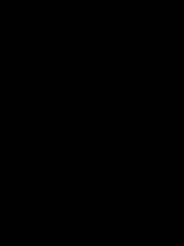 бильярдный стол баку: GÖZGÜ ÜŞÄ SARLIR QİYMÄTİ RAZRAŞMA VAR — 6