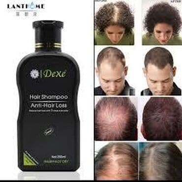 selenium sulfide 2.5 shampoo iran: Saç şampunu, Hər növ saçlar üçün, Yeni, Pulsuz çatdırılma — 2