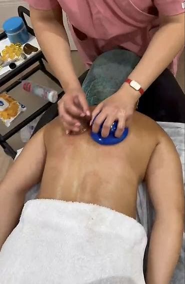 tebii sac rengleri: Hicama. Hacamat Nə Üçün Edilir? ​Detoks Təsiri: Qan dövranını ləngidən — 5