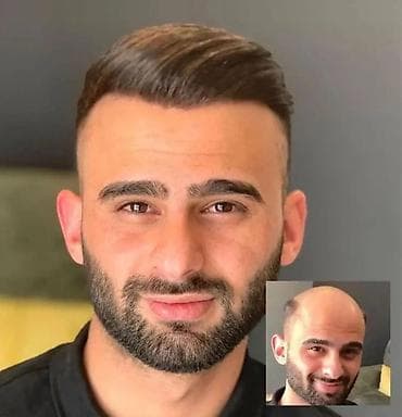 səkilləri: Qadın saç ustaları | Digər xidmət növü — 4
