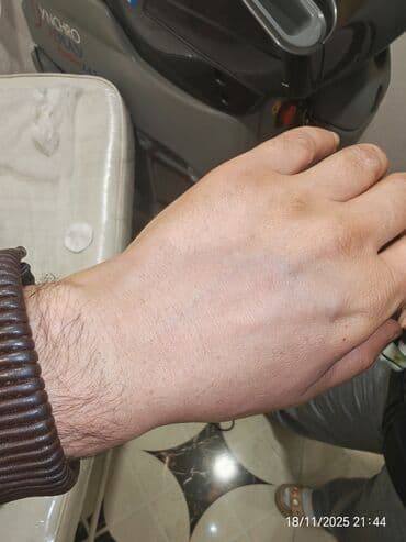 ilizarov aparatı qiymeti: Epilyasiya üçün, Aleksandrit, Təlim keçirilir — 5