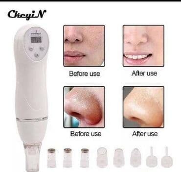 набор для проблемной кожи: Eziz musterilerimiz cox sayli istekleri nezere alaq sizler ucun — 1