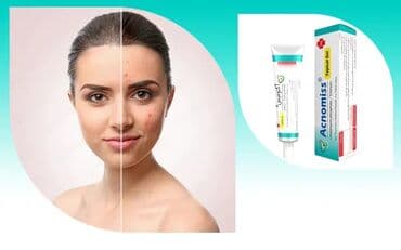 Bədənə qulluq: Üz geli, Akneyə meyilli dəri üçün, 20 ml, Yeni, Pulsuz çatdırılma — 2