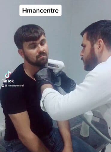 sari tukler ucun lazer: Kişilər üçün Lazer Epilasiya✅ Üz,Boyun,Boğaz,Qulaq,Burun = 10 AZN — 6