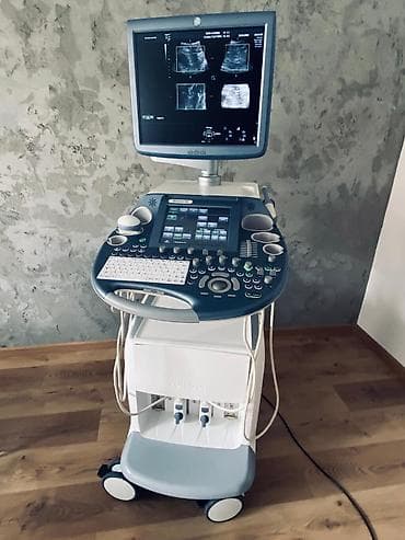 Voluson USM Voluson USM aparatı Yeni və ikinci hər növ USM lalafo.az -da Voluson USM Voluson USM aparatı Yeni və ikinci hər növ USM