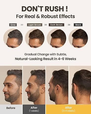 devit 3 qiyməti: Saç şampunu, Hər növ saçlar üçün, Yeni, Ünvandan götürmə, Pulsuz çatdırılma, Ödənişli çatdırılma — 3