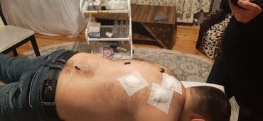 bioloji yaşam sağlamlıq mərkəzi: 📌hi̇cama nədi̇r❓ 🔷️qanalma ilə müalicə üsulu olaraq. Xəstəliklərə — 12