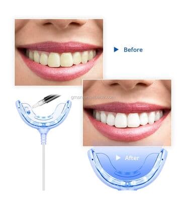 Diş ağardan
Həm elektrik həmdə telefonla idarə etmək olur