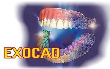 İstehsal avadanlığı: EXOCAD 3.3 9512 – diş texnologiyaları üçün CAD proqramı - Dişlərin — 1