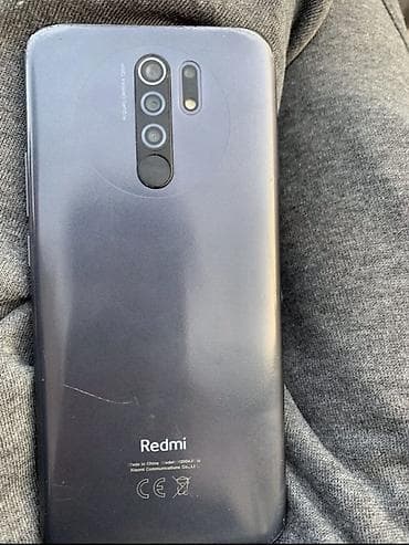 Ekraninda bidene çat var fso islemyinde cox problem yaratmir