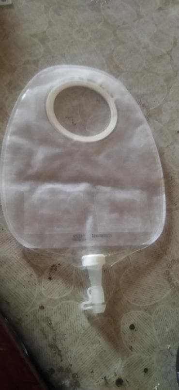 su torbası: Kolostomiya/Urostomiya üçün iki hissəli stoma sistemi sidik torbası — 2
