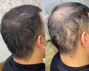 Saç Serumu – tökülmə və qırılmaya qarşı intensiv qulluq Məhsulun — 5