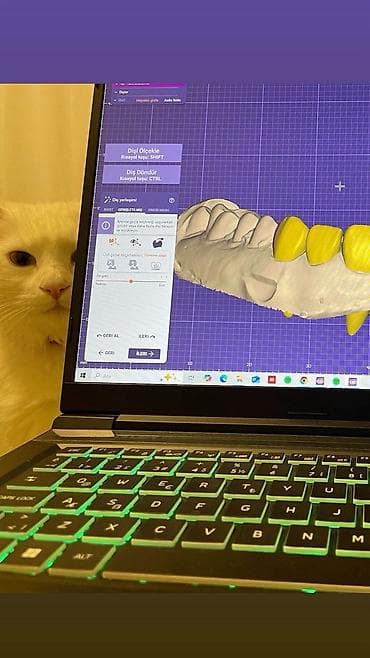 İstehsal avadanlığı: EXOCAD 3.3 9512 – diş texnologiyaları üçün CAD proqramı - Dişlərin — 2