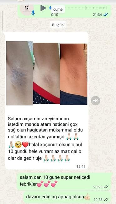 saat destleri: Qolaltı qaralma və ləkələr üçün ağardırıcı baxım seti Məhsulun — 5