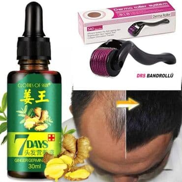 Dermaroller Saç berpasi yağı . ikisi bir yerdə #20Azn Tutum: 30ML — 1