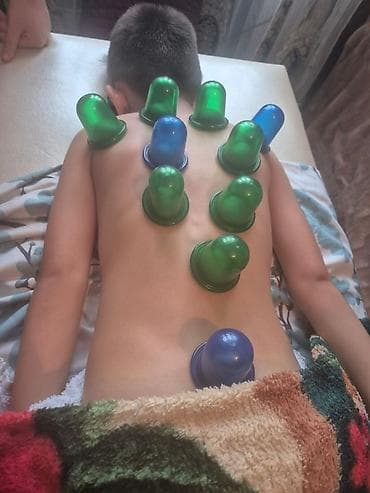 masaj doma: Vakuum masajı, Uşaqlar üçün — 1