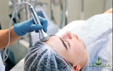 oksigen aparatlari: Hydro Facial 1. RF lifting - Dərini yığan və cavanlaşdıran cərrahi — 3