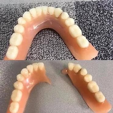 ustalar qrupu whatsapp: Qırılmiş cat, dişi duşmuş cixan protezlerin Hemin gun erzinde tez — 1