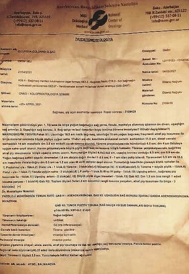 Другая салонная, медицинская мебель: 3 motorlu tibbi çarpayı Türkiyədən sifariş olunaraq gətirilib — 3