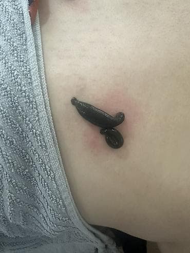 Красота и здоровье: Hirudoterapiya və Hicama (Qan çıxarma) xidməti - Hirudoterapiya — 5