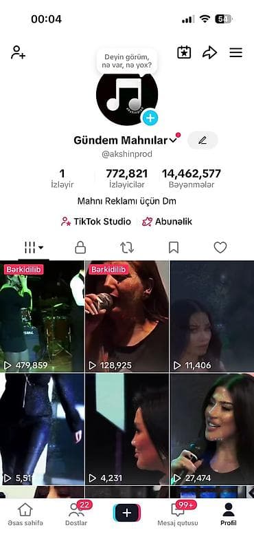 Tecili satılır real aliciya endirim olacaq.Xidmət: TikTok-da Mahnı