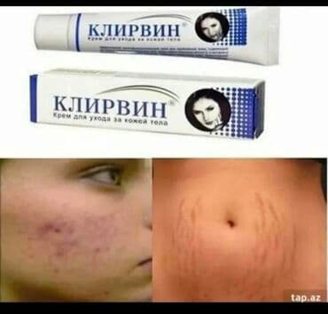 крем барои сафед кардани кус: Klirvin krem capiqlar eleyhine — 1