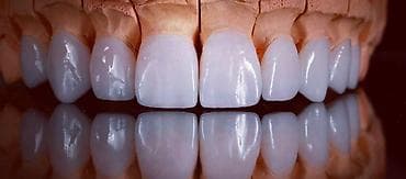 Paltar tikişi: Salam hörmətli və dəyərli Diş Həkimlərimiz.mən diş Texnikiyem.Bakının — 1