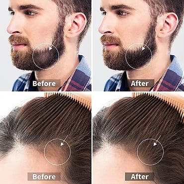 Bədənə qulluq: Üz üçün masajor, roller — 5