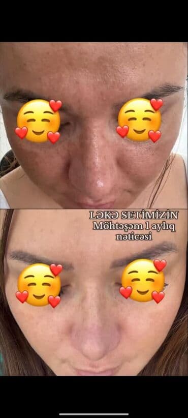 don sekilleri: Bu kremler netice superdi butun sekiller heqiqidi ve kasmetoloq — 7