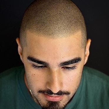 xidmət: Tatto nökte atişiylariyla tük effekti yaradib keçelliyi örten — 3