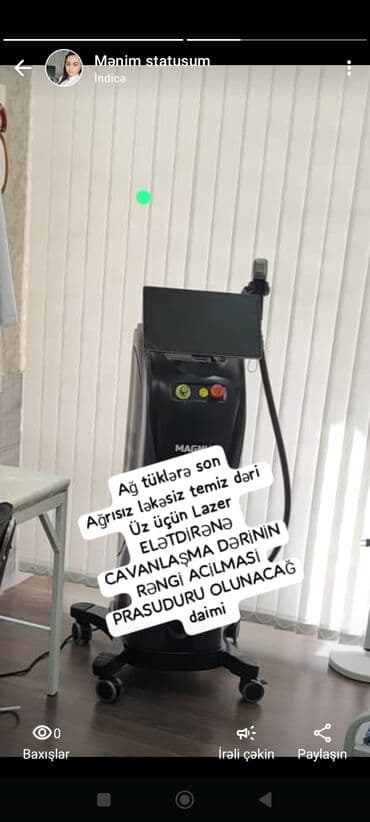 sari tukler ucun lazer: DIOD Lazer Aleksandrit Ağ tüklər üçün elektron epilyasiya AGARMA — 2