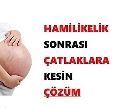 Hamiləlikdən sonra yaranan çatlaqlar üçün krem - Qarın, bel, ayaqlar